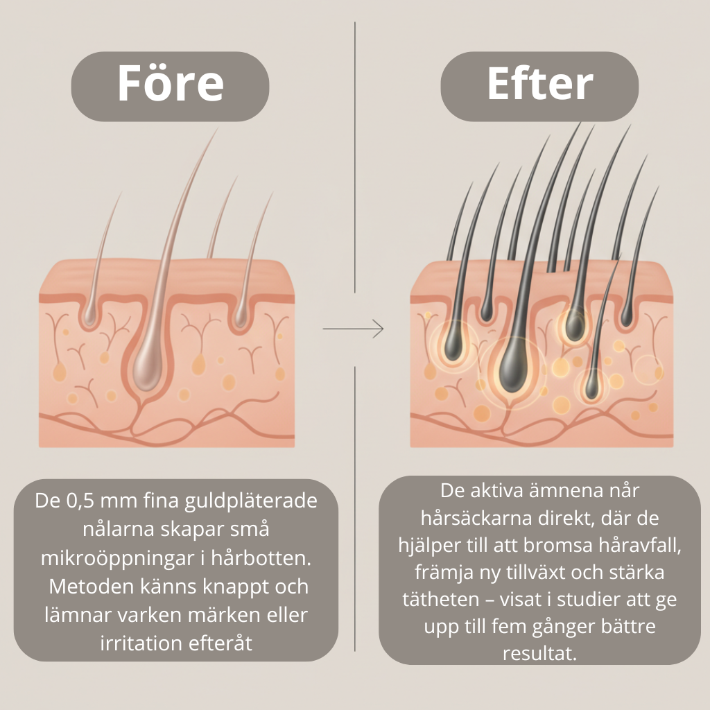 HairRevive Hårväxtsystem™
